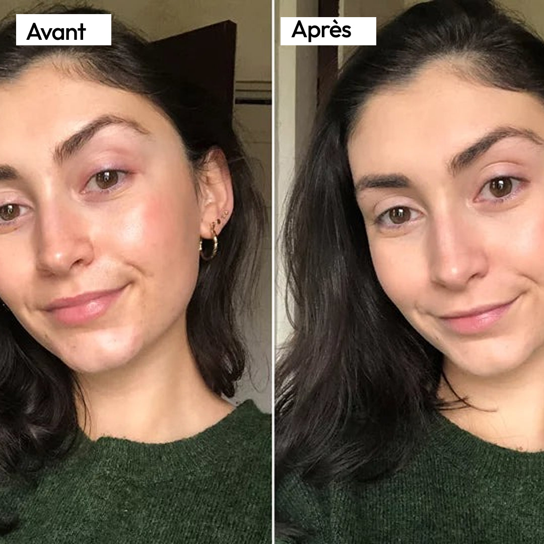 Rougeurs, teint terne et peau irrégulière ? Julie a retrouvé l'éclat.