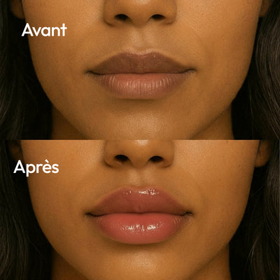 Repulpeur de lèvres à l'acide hyaluronique