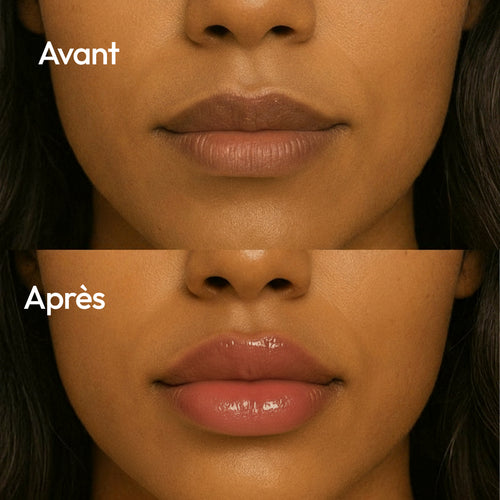Repulpeur de lèvres à l'acide hyaluronique
