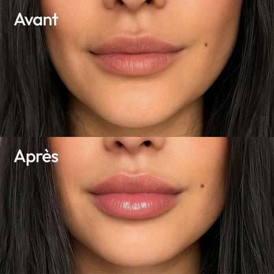 Repulpeur de lèvres à l'acide hyaluronique